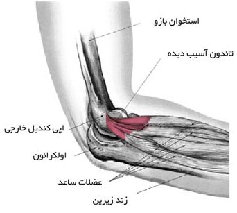 تنیس البو